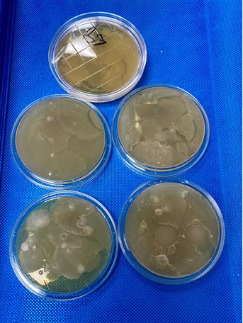 bacteria growing on an agar plate