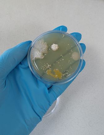 bacteria growing on an agar plate